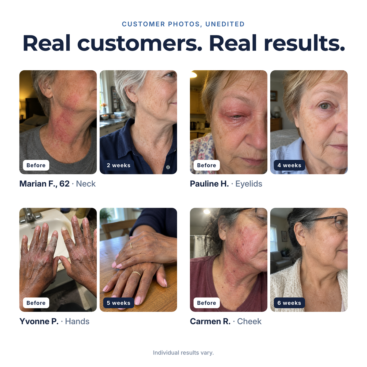 Before and after photos from four CLEARED customers: Marian, Pauline, Yvonne and Carmen