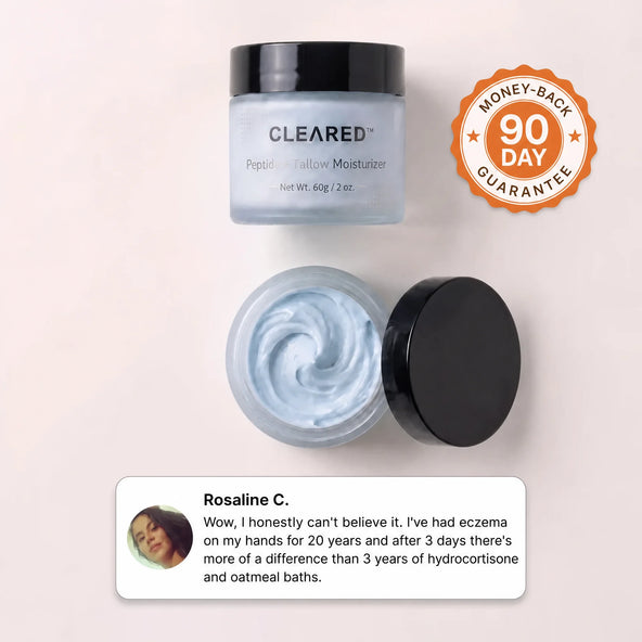 The Complete System for Eczema Prone Skin