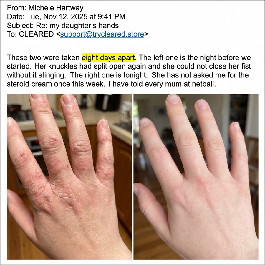 Review from Michele H. with before and after photos