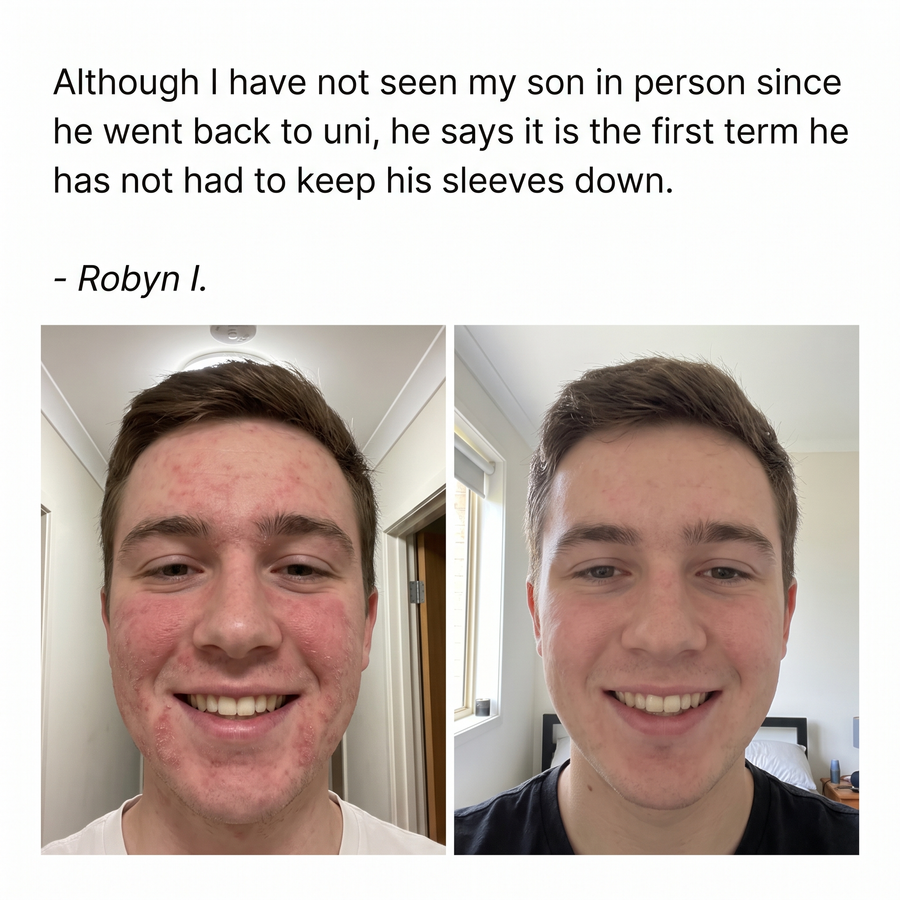 Review from Robyn I. with before and after photos