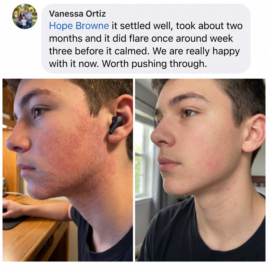 Review from Vanessa O. with before and after photos