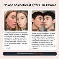 The Complete System for Eczema Prone Skin