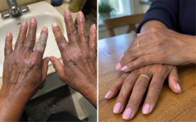 Yvonne Pryor, before and after